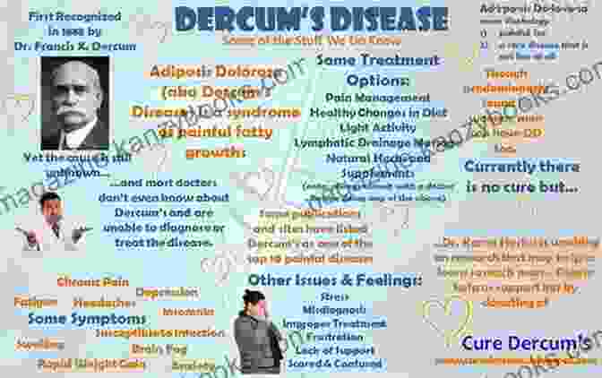 A Support Group Gathering For Individuals With Dercum Disease, Offering A Sense Of Community And Shared Experiences. A Simple Guide To Dercum S Disease (Adiposis Dolorosa) Diagnosis Treatment And Related Conditions