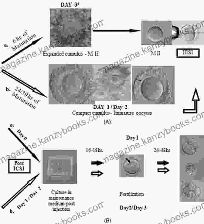 Acupuncture For Infertility Development Of In Vitro Maturation For Human Oocytes: Natural And Mild Approaches To Clinical Infertility Treatment