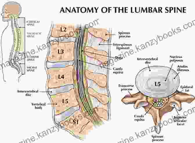 An Illustration Of The Lumbar Spine And The Nerves Affected By Lumbar Radiculopathy Sciatica Nerve Pain: Symptoms Tests And Treatments For Lumbar Radiculopathy