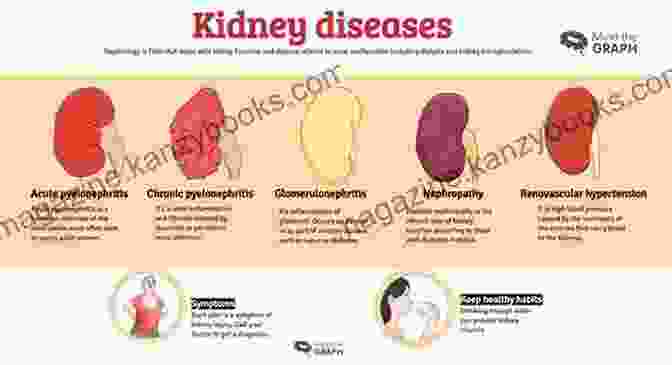 An Infographic Of The Urinary System And Common Diseases A Simple Guide To Urinary System Related Diseases And Use In Disease Diagnosis (A Simple Guide To Medical Conditions)