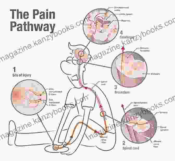 Anatomical Illustration Of Pain Pathways And Receptors A Quick Guide To Easing Pain: In The Work Place And Beyond