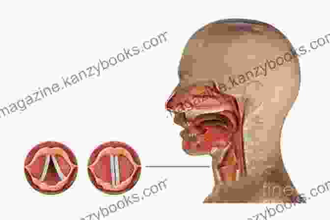 Anatomy Of The Voice Box A Simple Guide To Voice Box And Its DisFree Downloads Diagnosis Treatment And Related Conditions