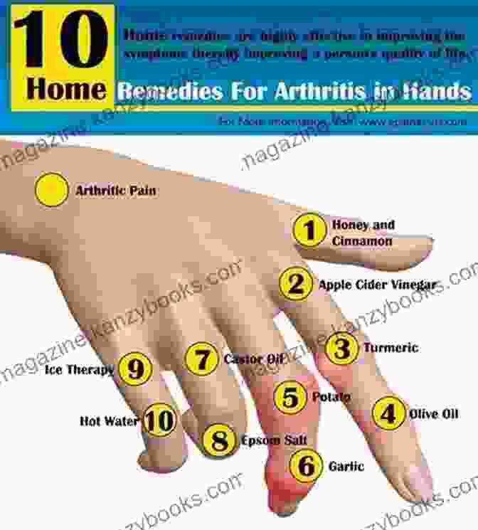 Arthritis Pain Management And Remedies You Should Know Book Cover Arthritis: Pain Management And Remedies You Should Know