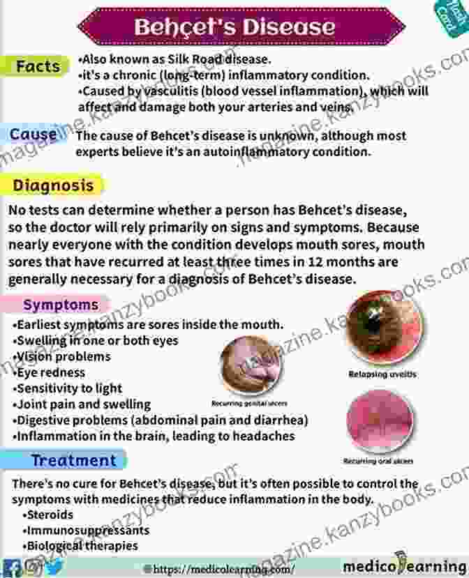 Behcet's Disease Symptoms: Oral Ulcers, Genital Ulcers, Uveitis A Simple Guide To Behcet S Disease Diagnosis Treatment And Related Conditions