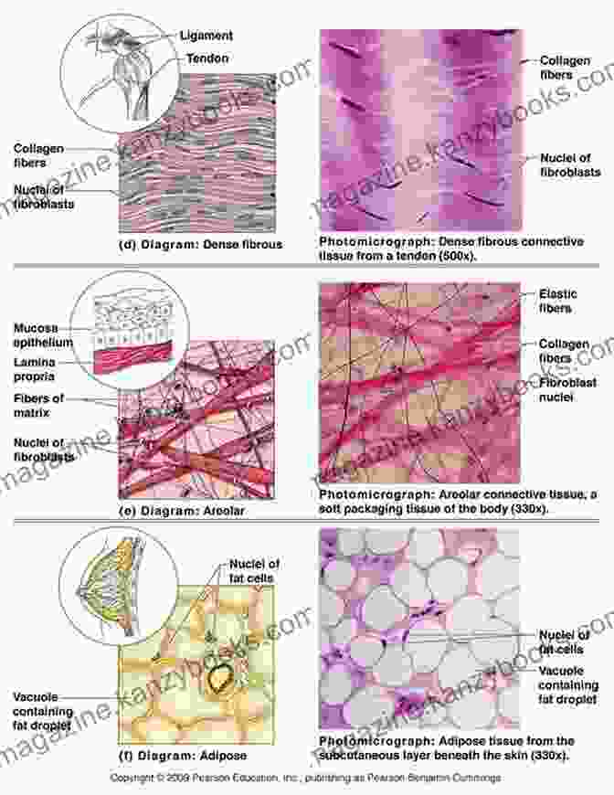 Diagram Illustrating The Structure Of Connective Tissues And Their Role In Joint Stability Hypermobility Of Joints Peter Beighton