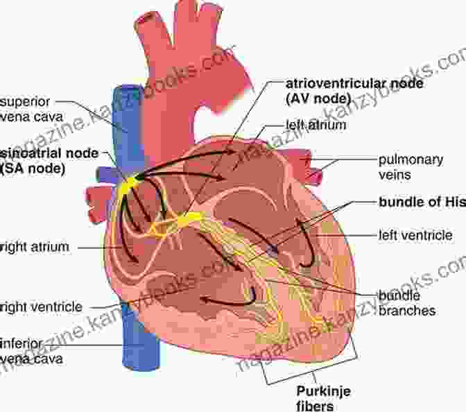 Diagram Of The Heart's Electrical System, Highlighting The Sinoatrial (SA) Node A Simple Guide To Pacemaker Syndrome Diagnosis Treatment And Related Conditions