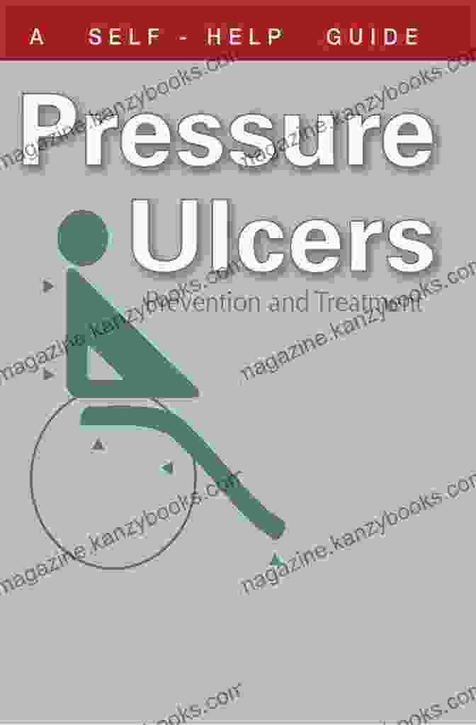 Dr. Guide Books The Doctor S Guide To Pressure Ulcers: Prevention And Treatment (Dr Guide Books)