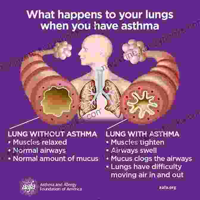 Image Showcasing Individuals With Asthma And Lung Diseases Living Fulfilling And Active Lives. A Simple Guide To Asthma And Lung Diseases (A Simple Guide To Medical Conditions)