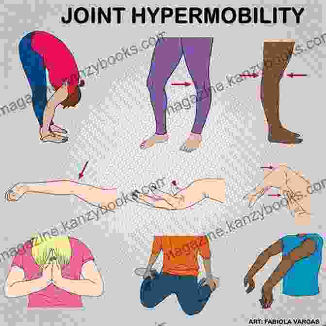 Infographic Depicting The Various Symptoms Associated With Hypermobility Hypermobility Of Joints Peter Beighton