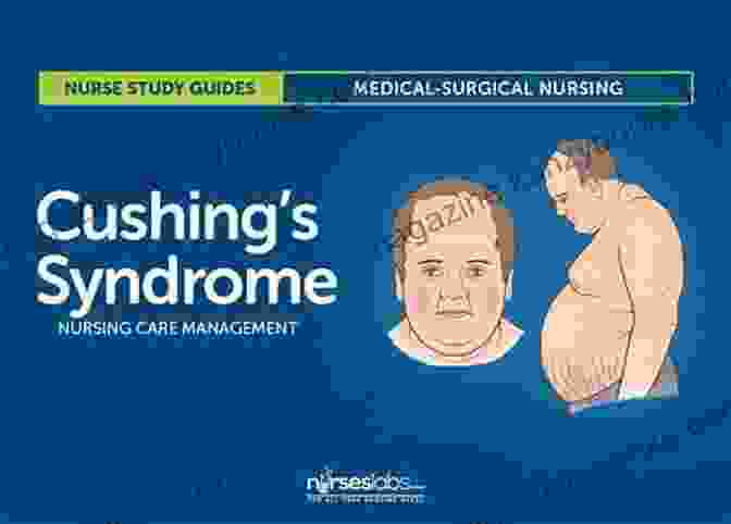 Simple Guide To Hypercortisolism: Cushing Syndrome Diagnosis, Treatment, And Recovery A Simple Guide To Hyper Cortisolism (Cushing Syndrome) Diagnosis Treatment And Related Conditions (A Simple Guide To Medical Conditions)