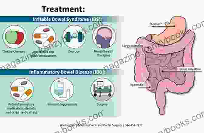 Simple Guide To Irritable Bowel Syndrome Treatment And Related Diseases A Simple Guide To Irritable Bowel Syndrome Treatment And Related Diseases (A Simple Guide To Medical Conditions)