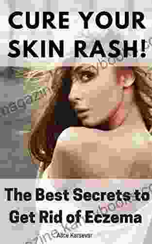 Cure Your Skin Rash The Best Secrets To Get Rid Of Eczema Itch And Skin Allergies