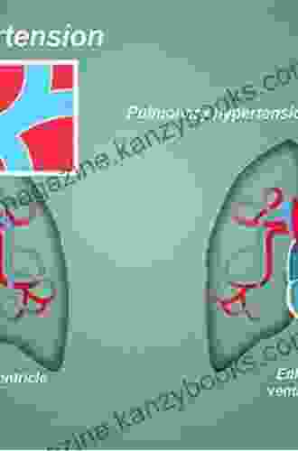 Pulmonary Arterial Hypertension (The Facts)