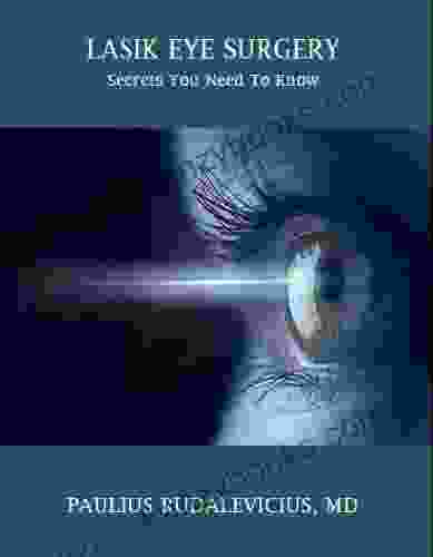 LASIK EYE SURGERY: SECRETS YOU NEED TO KNOW: A Patient s Guide to Safe LASIK Eye Surgery