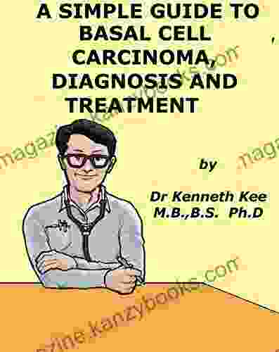 A Simple Guide To Basal Cell Carcinoma Diagnosis And Treatment (A Simple Guide To Medical Conditions)