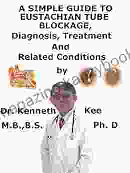 A Simple Guide To Eustachian Tube Blockage Diagnosis Treatment And Related Conditions