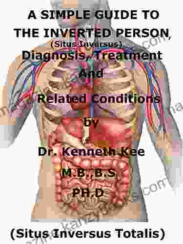 A Simple Guide To The Inverted Person (Situs Inversus) Diagnosis Treatment And Related Conditions