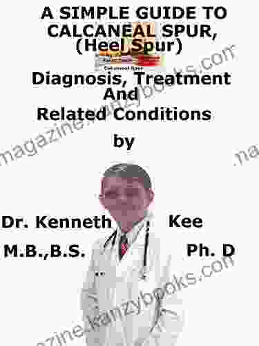 A Simple Guide To Calcaneal Spur (Heel Spur) Diagnosis Treatment And Related Conditions (A Simple Guide to Medical Conditions)