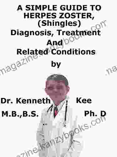 A Simple Guide To Herpes Zoster (Shingles) Diagnosis Treatment And Related Conditions