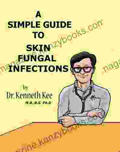 A Simple Guide To Skin Fungal Infections (A Simple Guide To Medical Conditions)