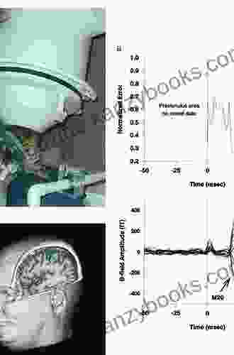 Clinical Applications of Magnetoencephalography Kent Heckenlively