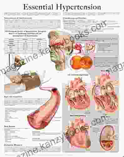 Essential Hypertension E Chart: Full Illustrated