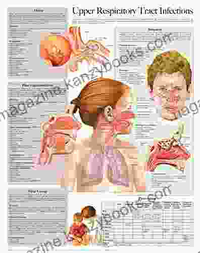 Upper Respiratory Tract Infections E Chart: Full Illustrated